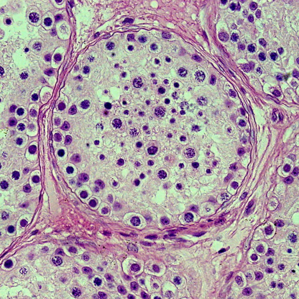 Cross-section of a 12 years old human testis.