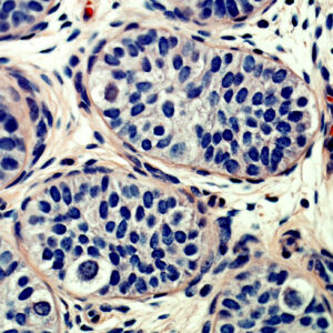 Cross-section of a 9 months old human testis.